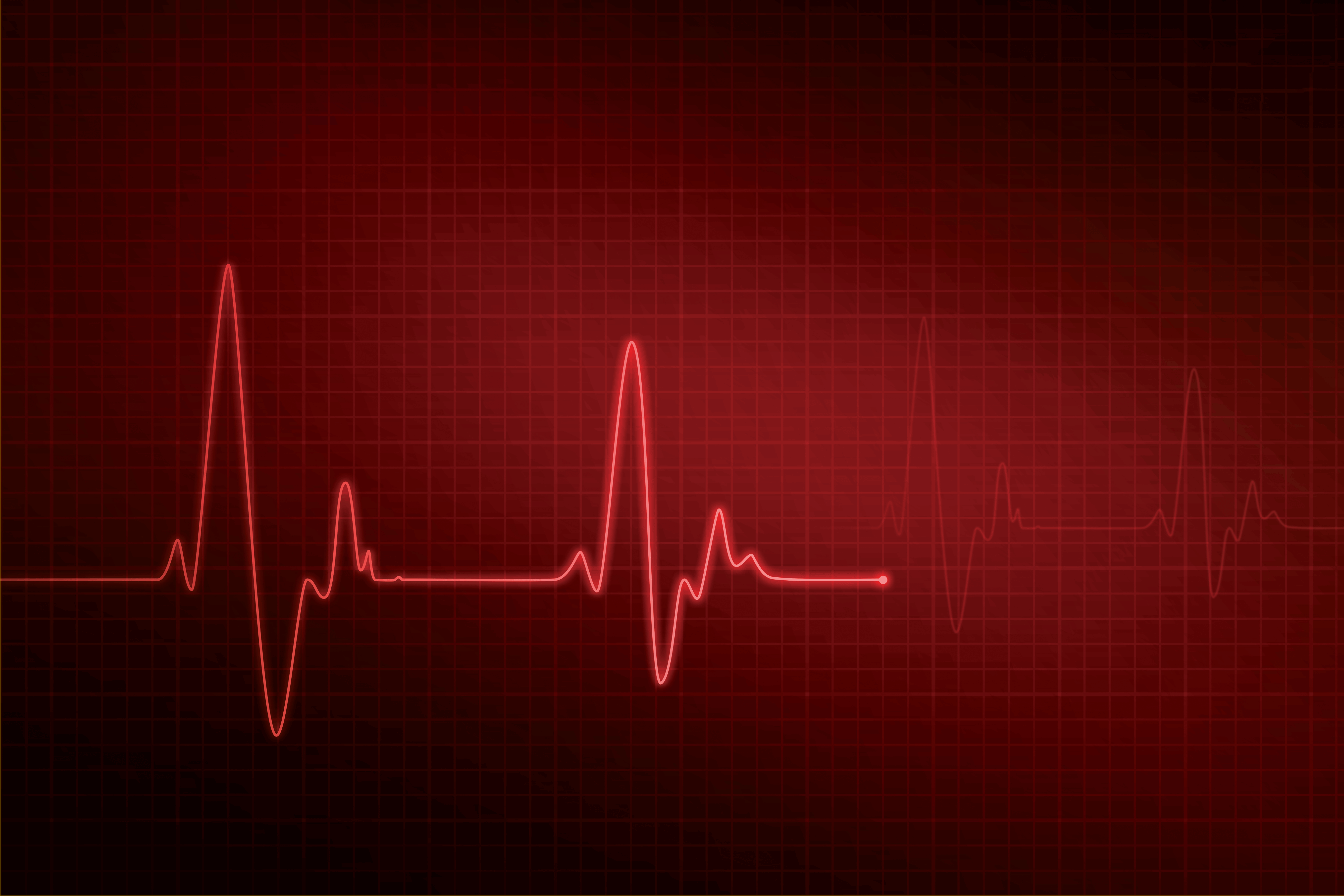 EFFECTS OF THE HEART - PERFORMANCE FLOOR
