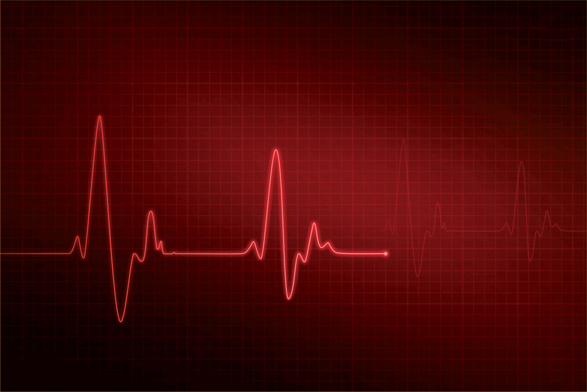 EFFECTS OF THE HEART - PERFORMANCE FLOOR